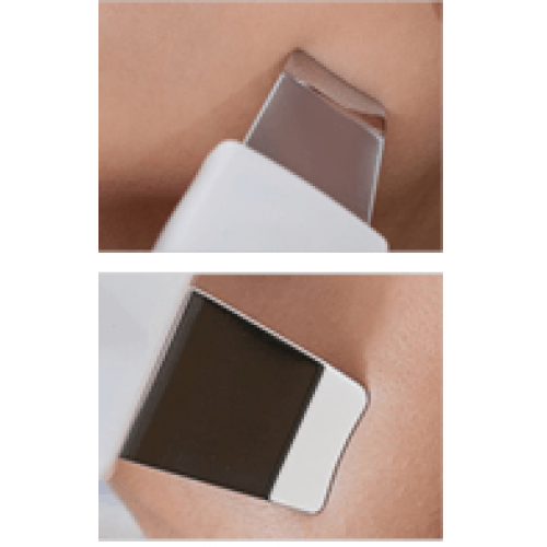 Аппарат косметологический "ИОНТО ПИЛ Соно"